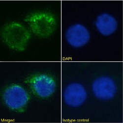Invitrogen CD11a Chimeric Recombinant Rabbit Monoclonal Antibody (MHM24) 200 &mu;g | Buy Online | Invitrogen&trade; | Fisher Scientific
