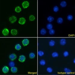 Invitrogen IL-6 Receptor (CD126) Chimeric Recombinant Rabbit Monoclonal