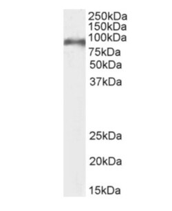 Invitrogen CD155 Chimeric Recombinant Rabbit Monoclonal Antibody (3F1)