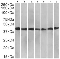 Invitrogen RAP Chimeric Recombinant Rabbit Monoclonal Antibody (7F1) 200