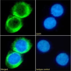 CD23 Chimeric Recombinant Rabbit Monoclonal Antibody (CAT-13.9C1), Invitrogen