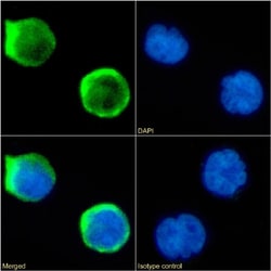 CD1a Chimeric Recombinant Rabbit Monoclonal Antibody (CBT6):Antibodies,