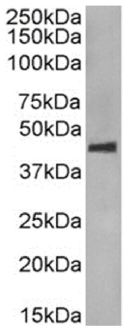 Invitrogen Phospho-CCR5 (Ser349) Chimeric Recombinant Rabbit Monoclonal