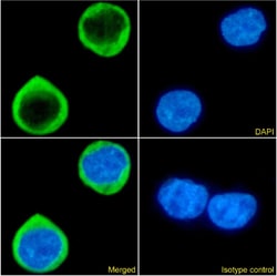 CCR5 Chimeric Recombinant Rabbit Monoclonal Antibody (RC-10):Antibodies,