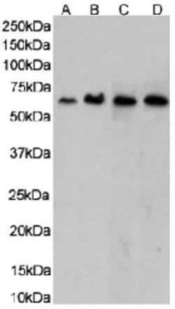 CCR5 Chimeric Recombinant Rabbit Monoclonal Antibody (RC-10):Antibodies,