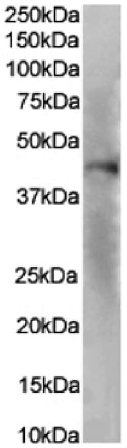 CXCR1 Chimeric Recombinant Rabbit Monoclonal Antibody (SE2):Antibodies,