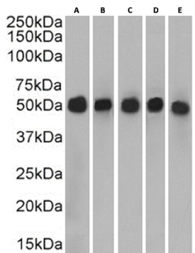 Cytokeratin 7 Chimeric Recombinant Rabbit Monoclonal Antibody (OV-TL 12 ...