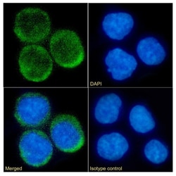 Invitrogen CD74 Chimeric Recombinant Rabbit Monoclonal Antibody (LL1 (EPB1))