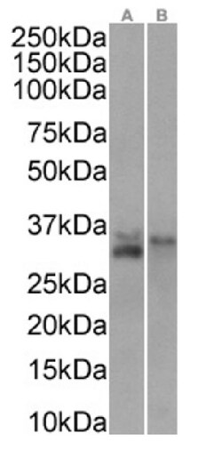 Invitrogen CD74 Chimeric Recombinant Rabbit Monoclonal Antibody (LL1 (EPB1))