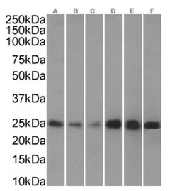 Invitrogen HP1 alpha Chimeric Recombinant Rabbit Monoclonal Antibody (RAB-C133)
