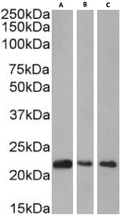 Invitrogen HP1 beta Chimeric Recombinant Rabbit Monoclonal Antibody (RAB-C145)