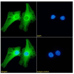 Invitrogen PRDM9 Chimeric Recombinant Rabbit Monoclonal Antibody (RAB-C370)