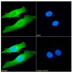 Invitrogen SETD7 Chimeric Recombinant Rabbit Monoclonal Antibody (RAB-C220) 200 &mu;g | Buy Online | Invitrogen&trade; | Fisher Scientific