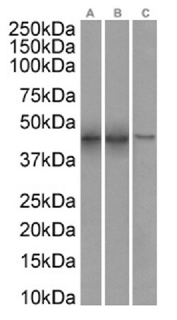Invitrogen SETD7 Chimeric Recombinant Rabbit Monoclonal Antibody (RAB-C220) 200 &mu;g | Buy Online | Invitrogen&trade; | Fisher Scientific