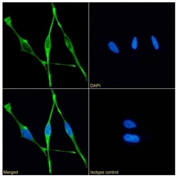 Invitrogen Mesothelin Chimeric Recombinant Rabbit Monoclonal Antibody (11-25)