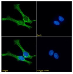 Invitrogen Mesothelin Chimeric Recombinant Rabbit Monoclonal Antibody (IC14-30) 200 &mu;g | Buy Online | Invitrogen&trade; | Fisher Scientific