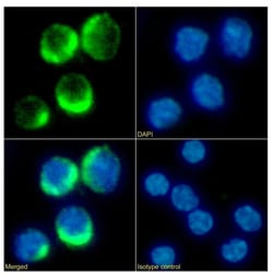 Invitrogen CD25 Chimeric Recombinant Rabbit Monoclonal Antibody (2E4) 200