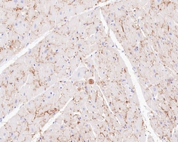 Connexin 43 Recombinant Rabbit Monoclonal Antibody (PSH0-32), Invitrogen