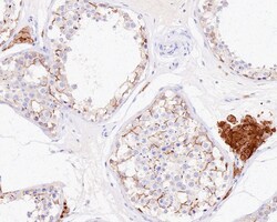Connexin 43 Recombinant Rabbit Monoclonal Antibody (PSH0-32), Invitrogen