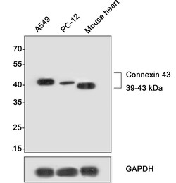 Connexin 43 Recombinant Rabbit Monoclonal Antibody (PSH0-32), Invitrogen