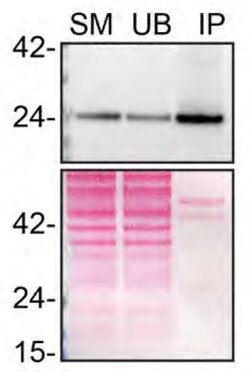 Invitrogen RAB8A Recombinant Rabbit Monoclonal Antibody (JE64-79) 100 &mu;L | Buy Online | Invitrogen&trade; | Fisher Scientific