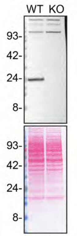 Invitrogen RAB8A Recombinant Rabbit Monoclonal Antibody (JE64-79) 100 &mu;L | Buy Online | Invitrogen&trade; | Fisher Scientific