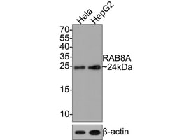 Invitrogen RAB8A Recombinant Rabbit Monoclonal Antibody (JE64-79) 100 &mu;L | Buy Online | Invitrogen&trade; | Fisher Scientific