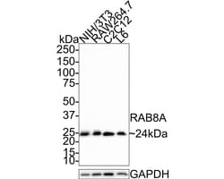 Invitrogen RAB8A Recombinant Rabbit Monoclonal Antibody (JE64-79) 100 &mu;L | Buy Online | Invitrogen&trade; | Fisher Scientific