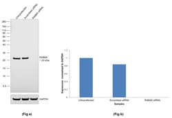 Invitrogen RAB8A Recombinant Rabbit Monoclonal Antibody (JE64-79) 100 &mu;L | Buy Online | Invitrogen&trade; | Fisher Scientific