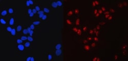 Invitrogen SP1 Monoclonal Antibody (3C4C3) 100 &mu;g; Unconjugated:Antibodies,