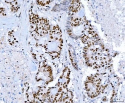 Invitrogen SP1 Monoclonal Antibody (3C4C3) 100 &mu;g; Unconjugated:Antibodies,