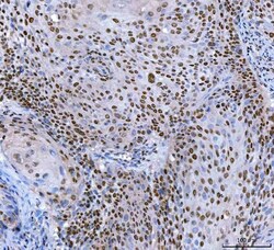Invitrogen SP1 Monoclonal Antibody (3C4C3) 100 &mu;g; Unconjugated:Antibodies,