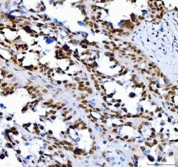 Invitrogen SP1 Monoclonal Antibody (3C4C3) 100 &mu;g; Unconjugated:Antibodies,