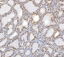 Invitrogen SP1 Monoclonal Antibody (3C4C3) 100 &mu;g; Unconjugated:Antibodies,