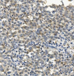 Invitrogen CCR2 Monoclonal Antibody (8C4) 100 &mu;g; Unconjugated:Antibodies,