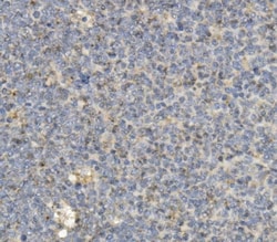 Invitrogen CCR2 Monoclonal Antibody (8C4) 100 &mu;g; Unconjugated:Antibodies,