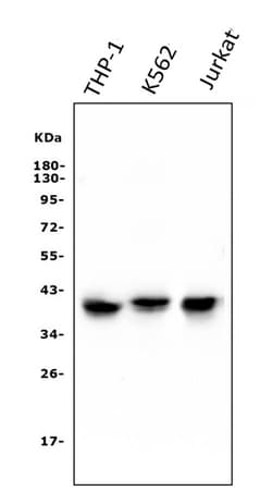Invitrogen CCR2 Monoclonal Antibody (8C4) 100 &mu;g; Unconjugated:Antibodies,