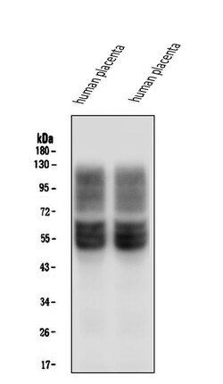 Invitrogen GLUT1 Monoclonal Antibody (10C10) 100 &mu;g; Unconjugated:Antibodies,