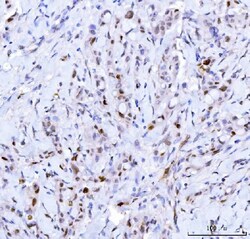 CDK2 Monoclonal Antibody (5B12D1), Invitrogen 100 &mu;g; Unconjugated:Antibodies,