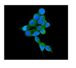 Invitrogen COMT Monoclonal Antibody (15C10) 100 &mu;g; Unconjugated:Antibodies,