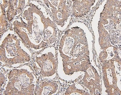 Invitrogen COMT Monoclonal Antibody (15C10) 100 &mu;g; Unconjugated:Antibodies,