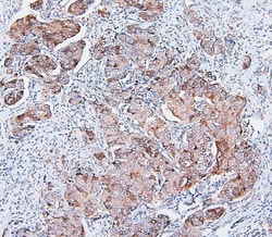 Invitrogen COMT Monoclonal Antibody (15C10) 100 &mu;g; Unconjugated:Antibodies,