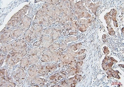 Invitrogen COMT Monoclonal Antibody (15C10) 100 &mu;g; Unconjugated:Antibodies,