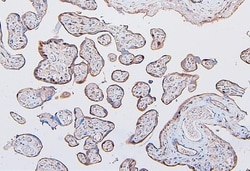 Invitrogen COMT Monoclonal Antibody (15C10) 100 &mu;g; Unconjugated:Antibodies,