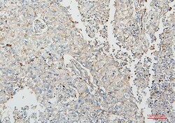 Invitrogen COMT Monoclonal Antibody (15C10) 100 &mu;g; Unconjugated:Antibodies,