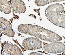 Invitrogen COMT Monoclonal Antibody (15C10) 100 &mu;g; Unconjugated:Antibodies,