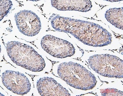 Invitrogen COMT Monoclonal Antibody (15C10) 100 &mu;g; Unconjugated:Antibodies,