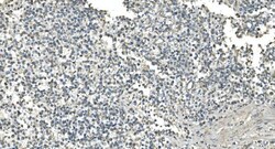 Invitrogen IDH2 Monoclonal Antibody (6B13) 100 &mu;g; Unconjugated:Antibodies,