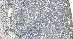 Invitrogen IDH2 Monoclonal Antibody (6B13) 100 &mu;g; Unconjugated:Antibodies,