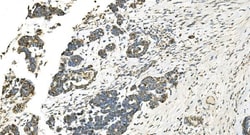 Invitrogen IDH2 Monoclonal Antibody (6B13) 100 &mu;g; Unconjugated:Antibodies,